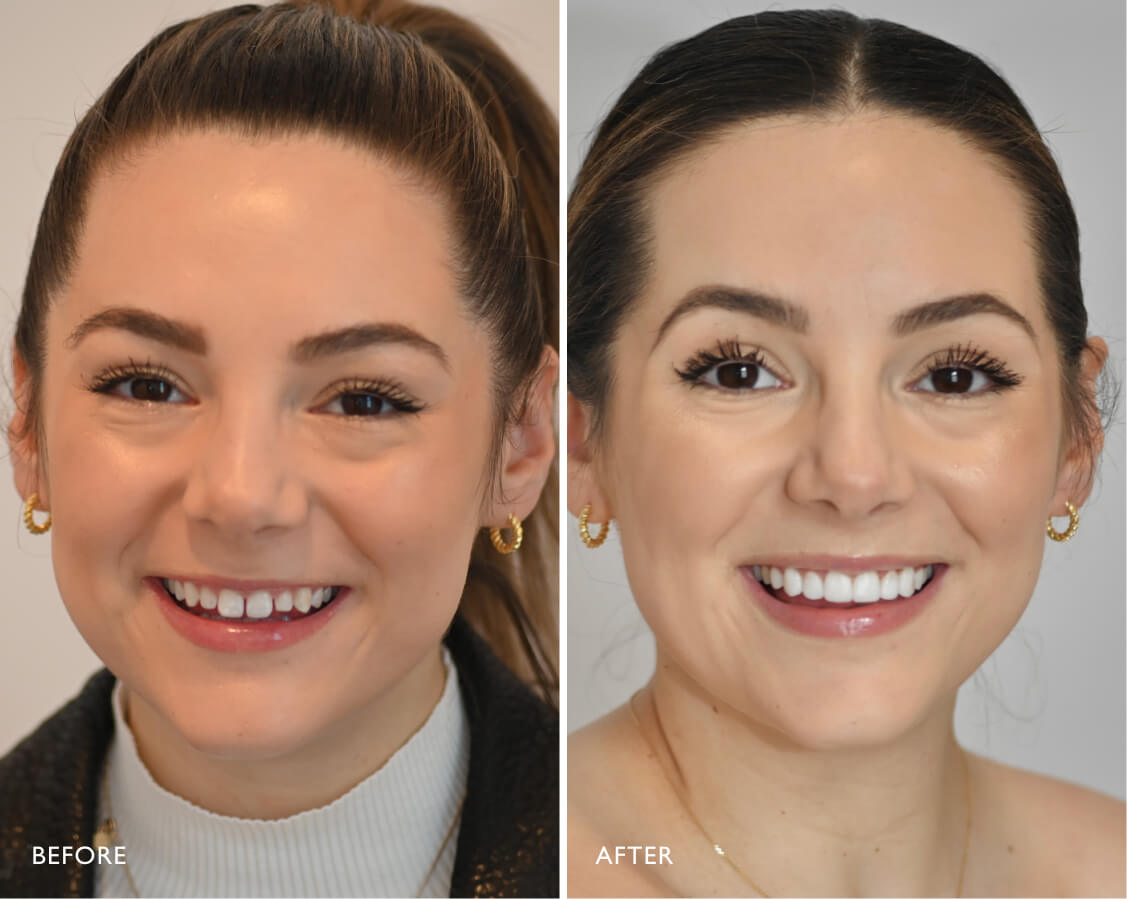 cosmetic dentist melbourne